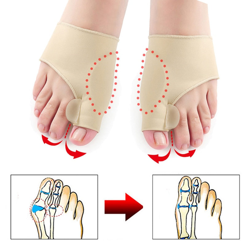 bunion correctors
