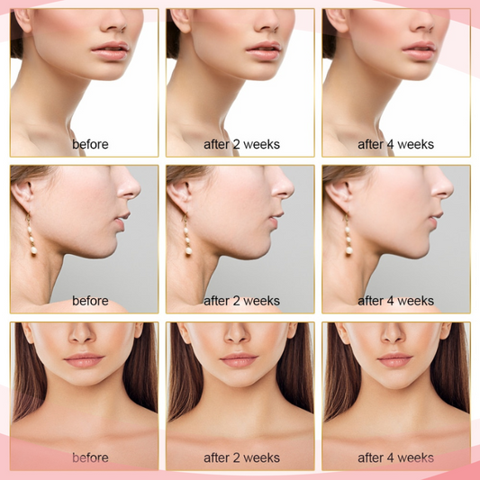 EMS Rechargeable V-Line Facial Massager