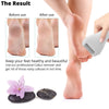 Rechargeable Skin Callus Remover USB Electric Foot File for Heel Grinding Pedicure Tool Professional Foot Care Tool Dead Hard Skin