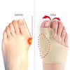 bunion correctors